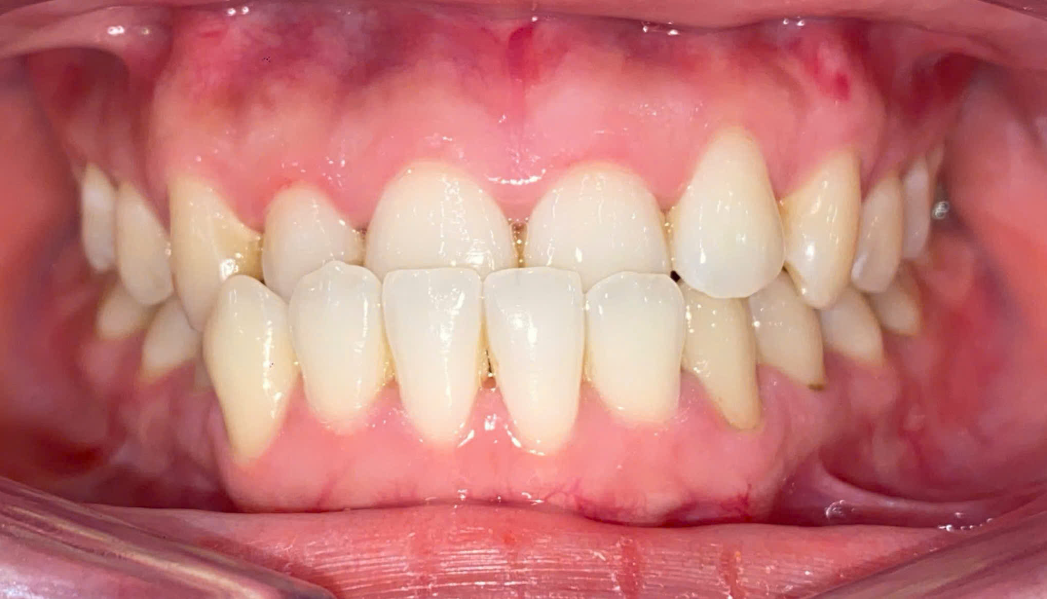 Before image