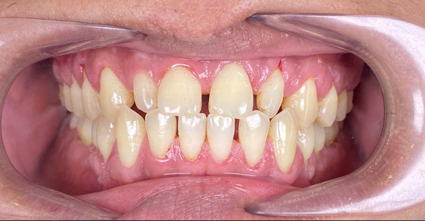 Before image