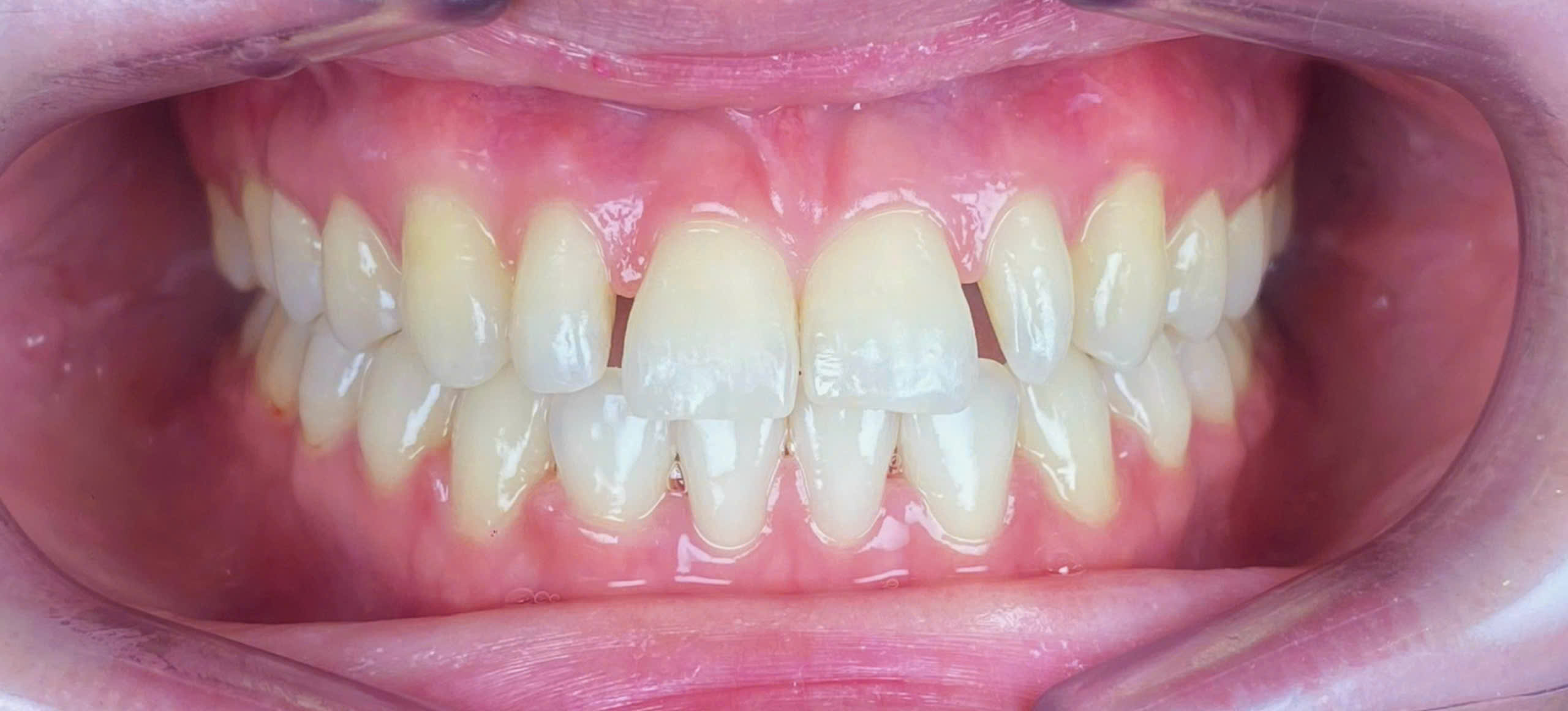 Before image